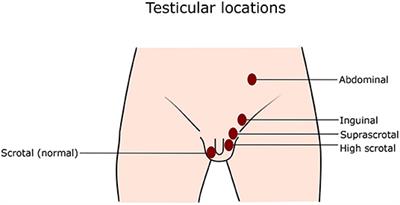 Frontiers Hypogonadism and Cryptorchidism